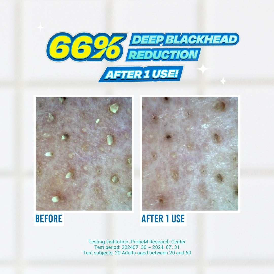 JUMISO Blackhead Melting Softener (includes 40 cotton pads)