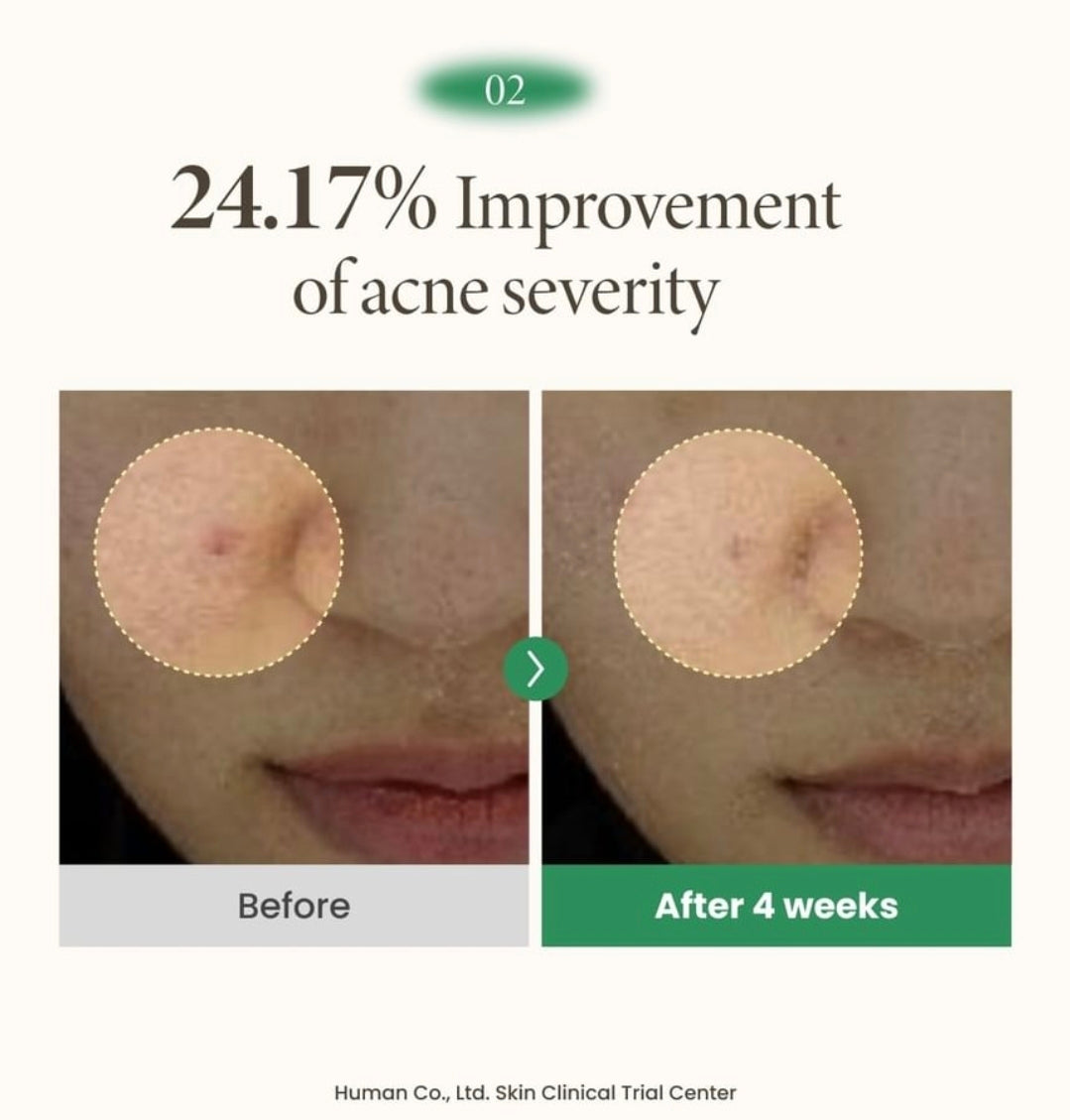 AXIS - Y  Spot The Difference Blemish Treatment 0.5 fl oz (15ml)