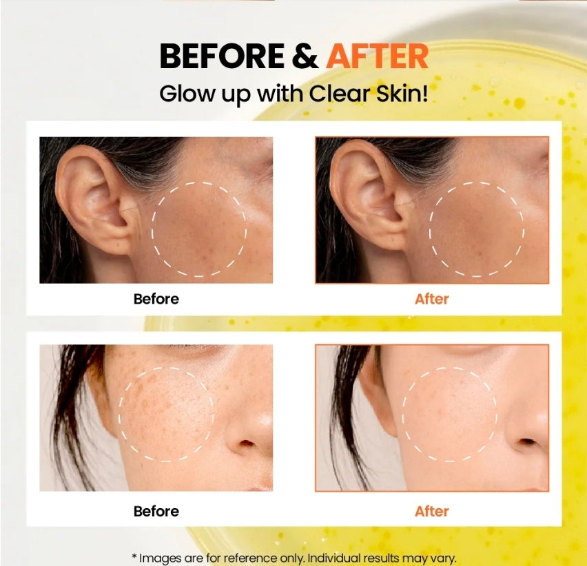 KSECRET SEOUL 1988 Glow Serum : Niacinamide 15% + Yuja 30ml original