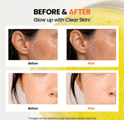 KSECRET SEOUL 1988 Glow Serum : Niacinamide 15% + Yuja 30ml original