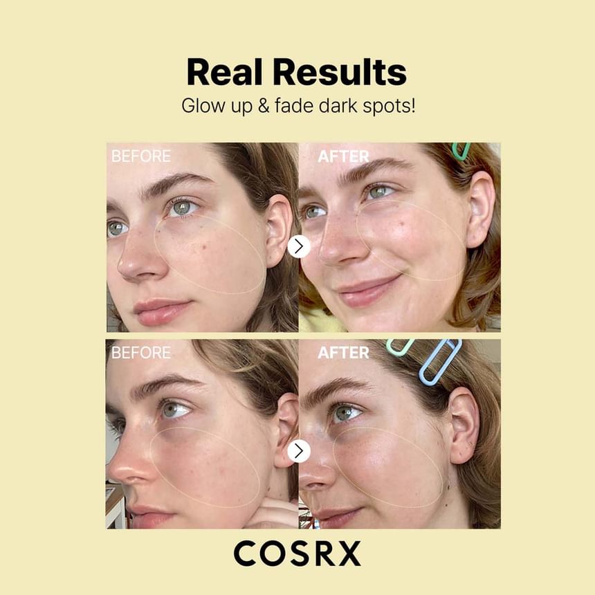 COSRX The Vitamin C 23 Serum